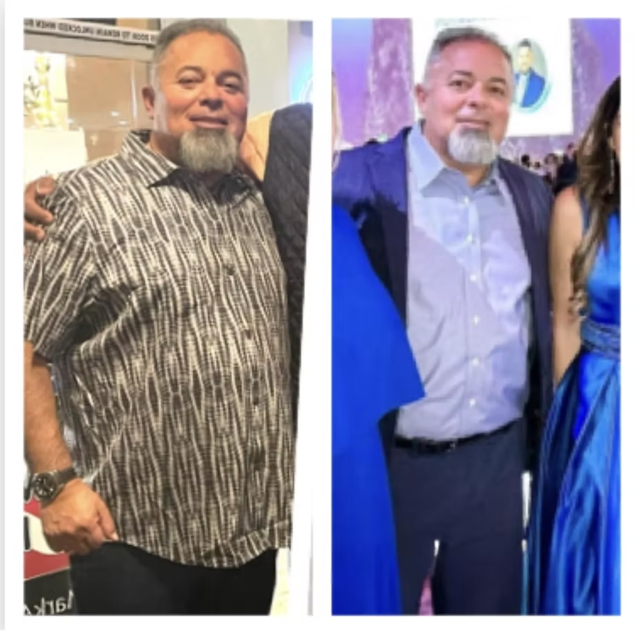 BR Weight Loss Journey