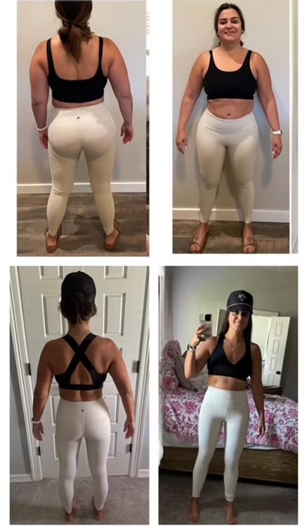 ER Weight Loss Journey